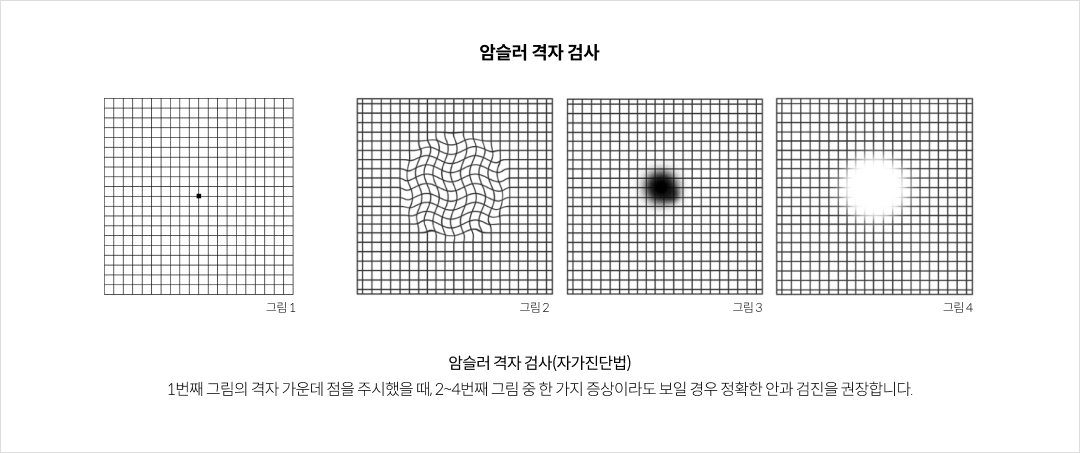 암슬러 격자 검사