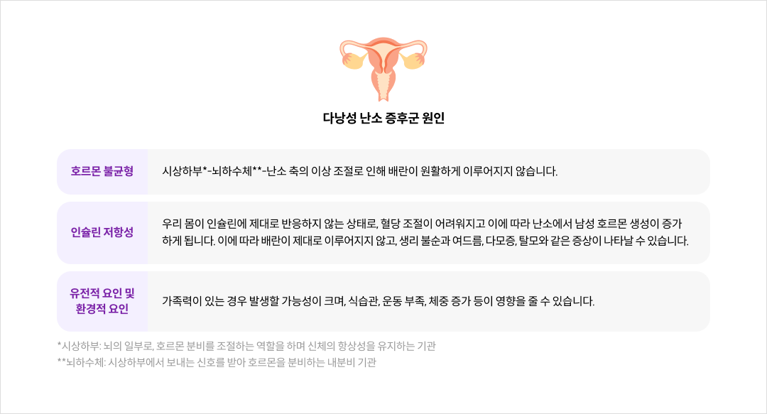 mgz_pcos_img2_pc.png 다낭성 난소 증후군 원인