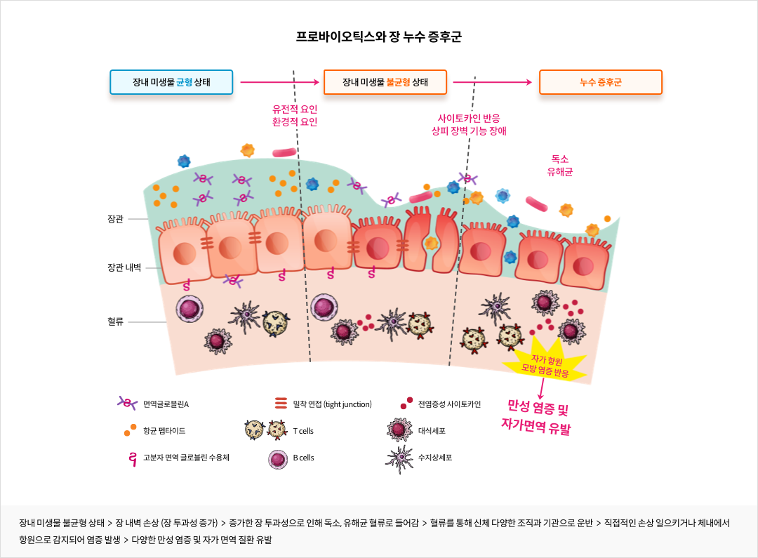 프로바이오틱스와 장 누수 증후군